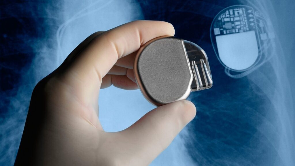 medical device components